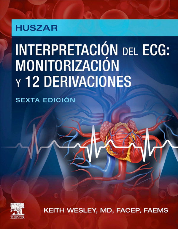 Interpretación del ECG monitorización y 12 derivaciones 6ª Ed.