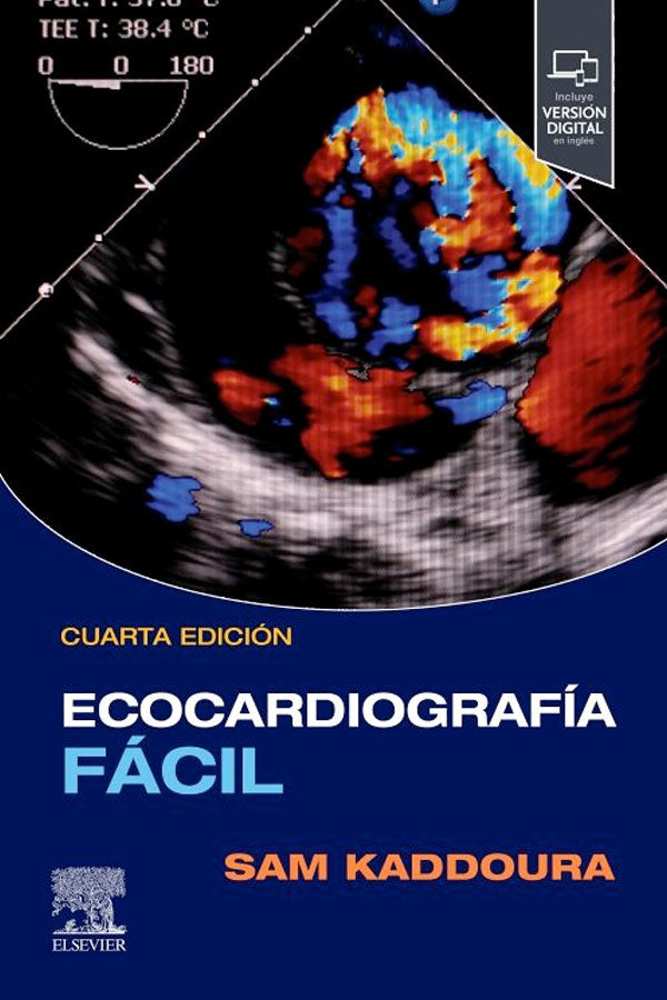 Ecocardiografía fácil 4ª Ed.