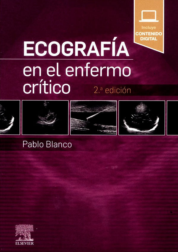 Ecografía en el enfermo critico 2ª Ed.