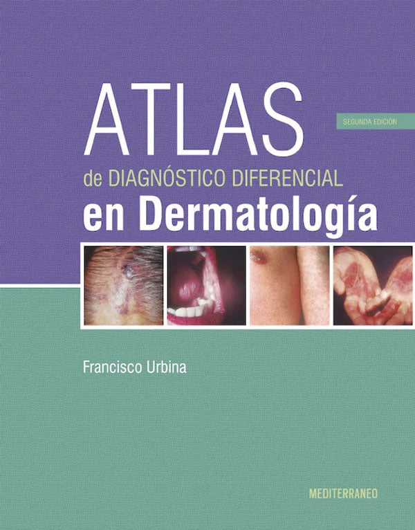 Atlas de diagnóstico diferencial en dermatología