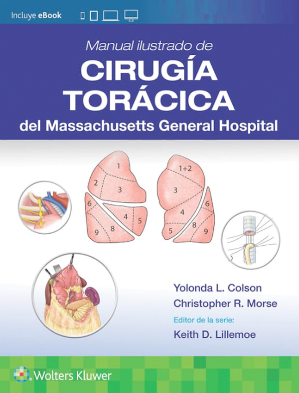 Manual ilustrado de Cirugía torácica del Massachusetts General Hospital