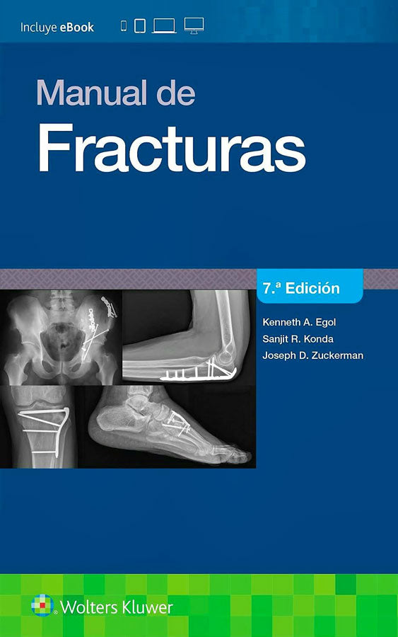 Manual de fracturas 7ª Ed.