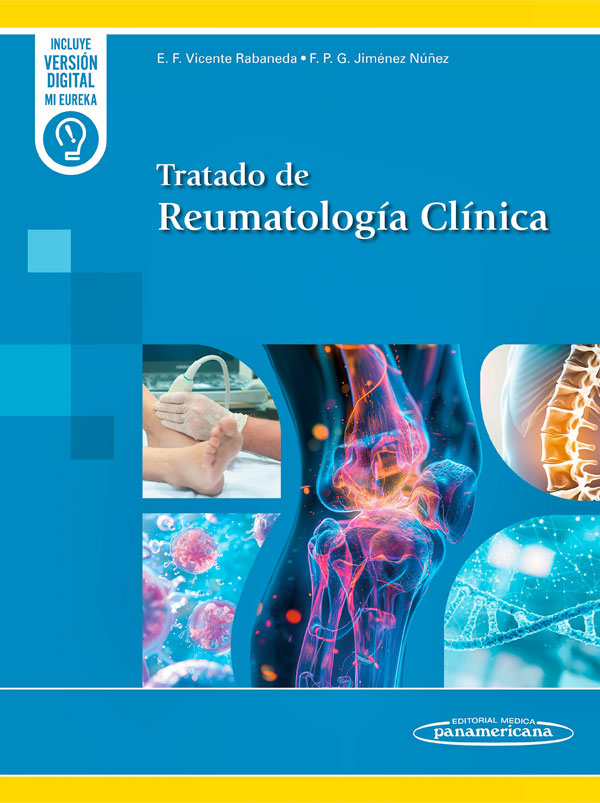 Tratado de reumatología clínica