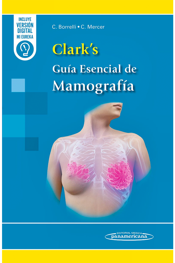 Clark's Guía esencial de mamografía