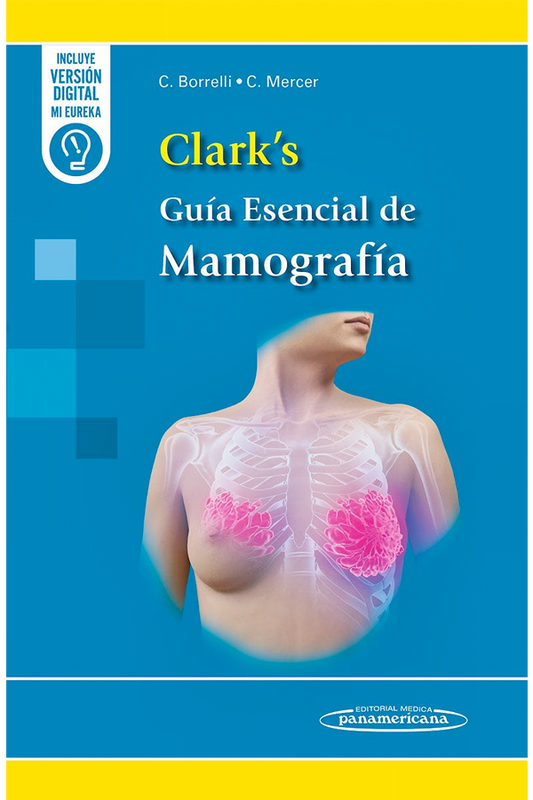 Clark's Guía esencial de mamografía