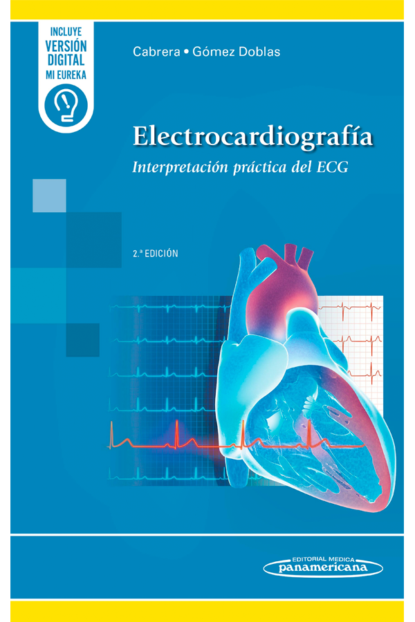 Electrocardiografía 2ª Ed. Interpretación práctica del ECG