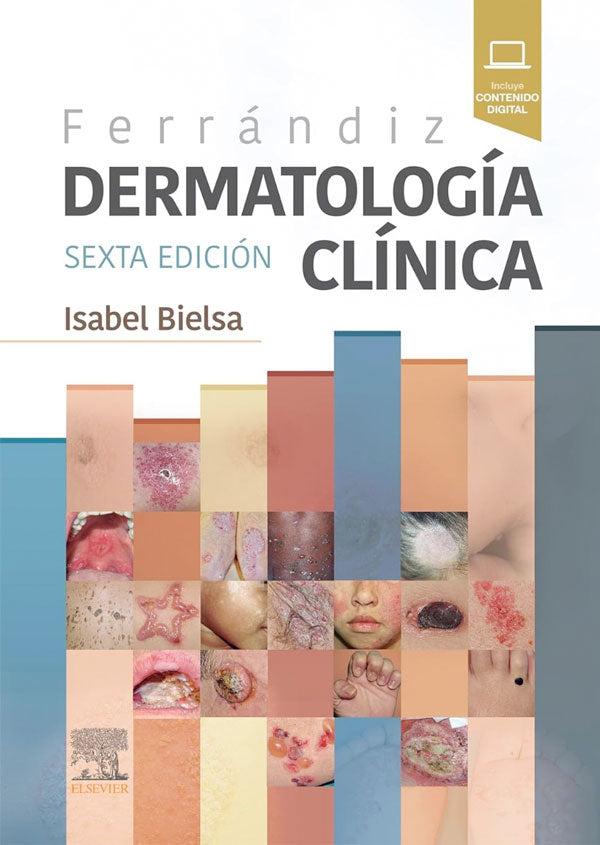 Ferrándiz. Dermatología clínica 6ª Ed.