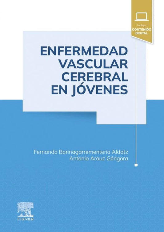 Enfermedad vascular cerebral en jóvenes