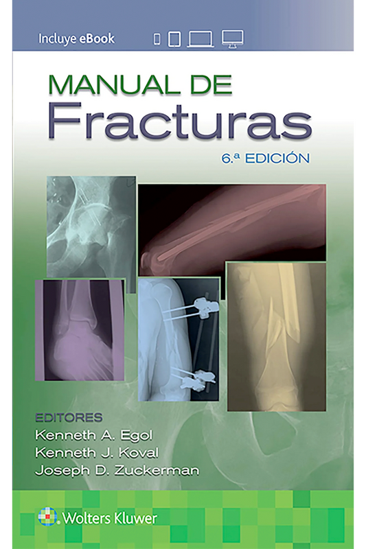 Manual de fracturas 6ª Ed.