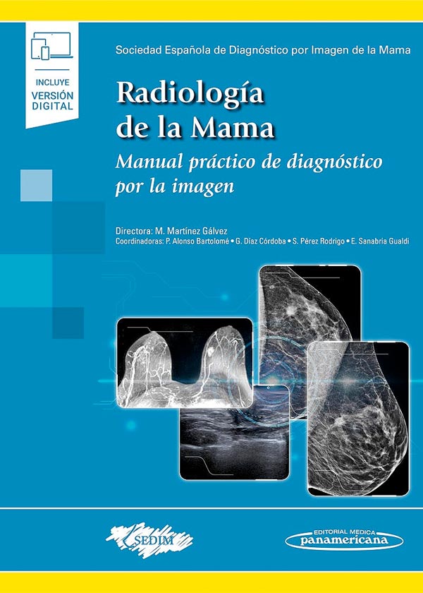 Radiología de la mama. Manual práctico de diagnóstico por la imagen