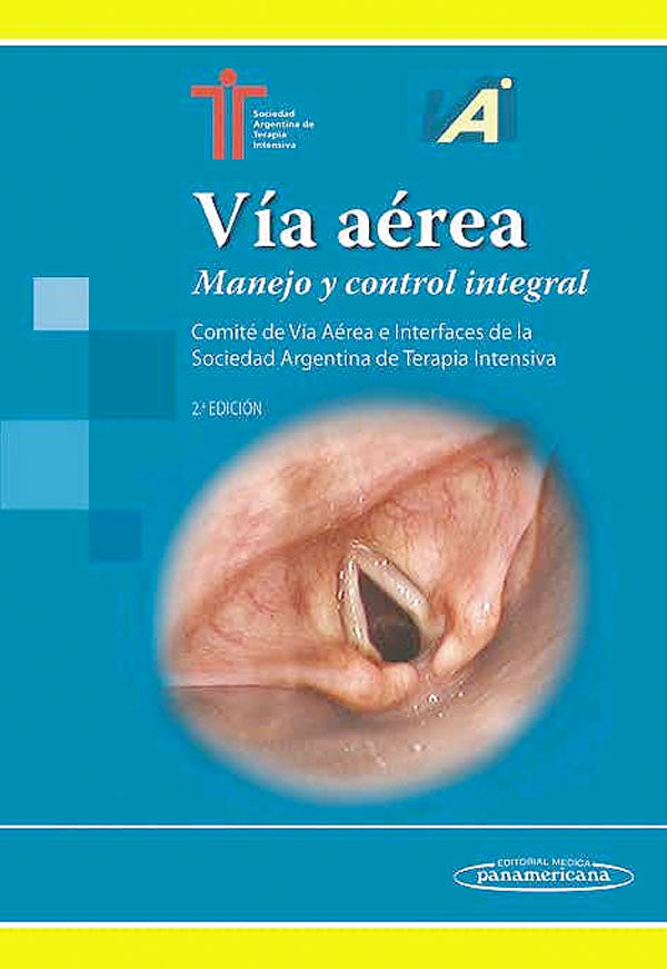 Vía aéra manejo y control integral 2ª Ed.