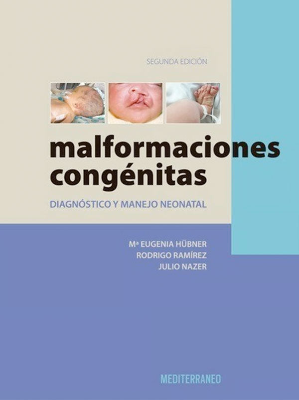 Malformaciones congénitas 2ª Ed.