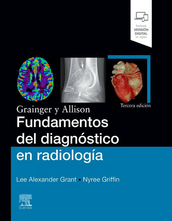 Grainger y Allison. Fundamentos del diagnóstico en radiología 3ª Ed.